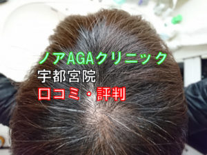 ノアAGAクリニックの口コミ・評判